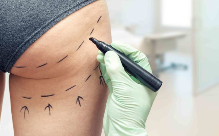 Ανόρθωση Γλουτών – Αποκτήστε καλοσχηματισμένους, νεανικούς γλουτούς Ανόρθωση Γλουτών – Αποκτήστε καλοσχηματισμένους, νεανικούς γλουτούς